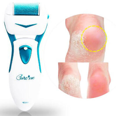 Callus Remover by Care Me